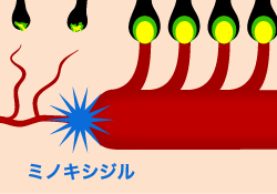 ミノキシジル