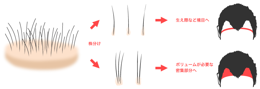 当院ならではの自然な仕上がり